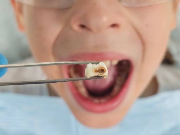 Best Emergency Dental Surgery in Lowell, NC